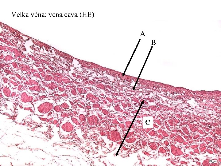 Velká véna: vena cava (HE) A B C 