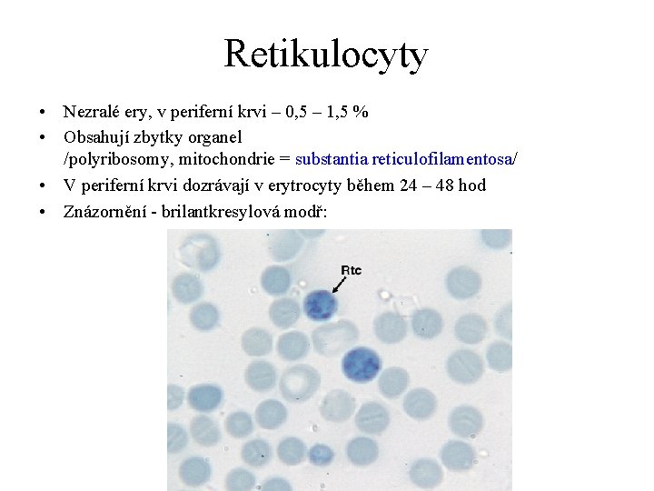 Retikulocyty • Nezralé ery, v periferní krvi – 0, 5 – 1, 5 %