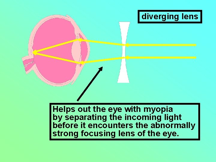 diverging lens Helps out the eye with myopia by separating the incoming light before