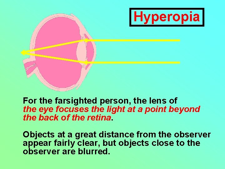 Hyperopia For the farsighted person, the lens of the eye focuses the light at