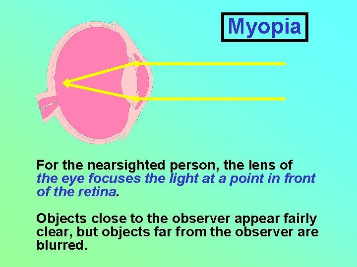 Myopia For the nearsighted person, the lens of the eye focuses the light at
