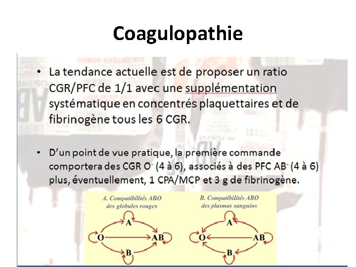 Coagulopathie 