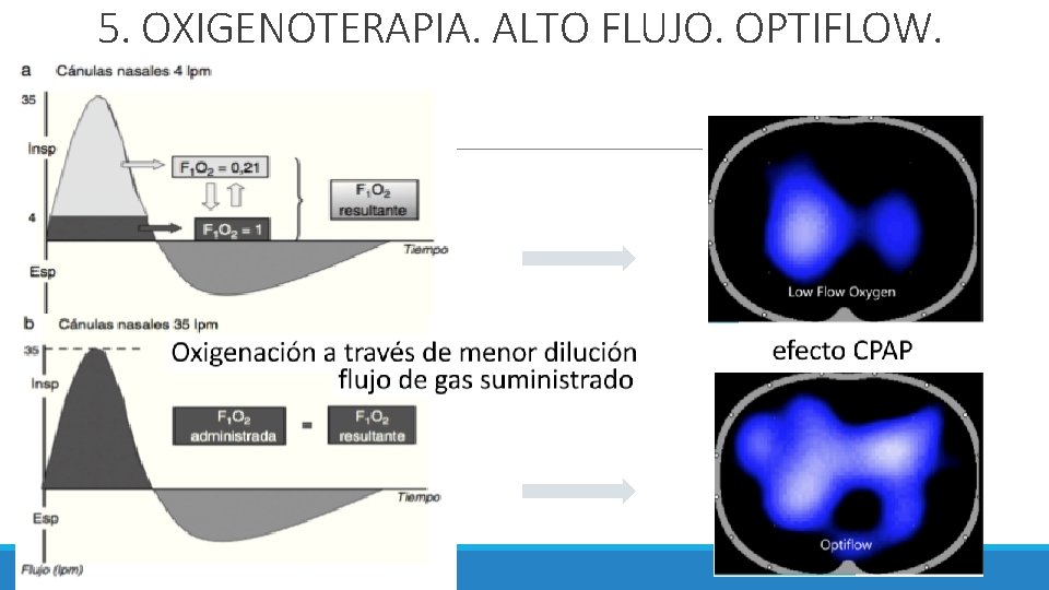 5. OXIGENOTERAPIA. ALTO FLUJO. OPTIFLOW. 5. OXIGENOTERAPIA. ALTO FLUJO. OPTIFLOW.
