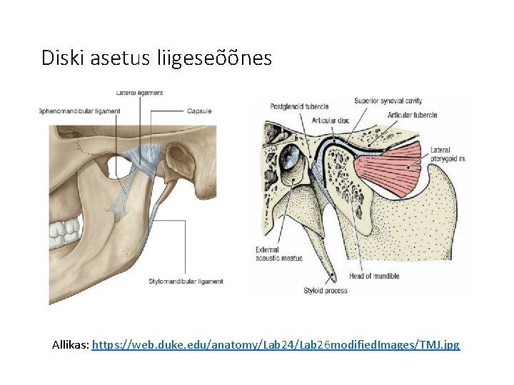 Diski asetus liigeseõõnes Allikas: https: //web. duke. edu/anatomy/Lab 24/Lab 26 modified. Images/TMJ. jpg 