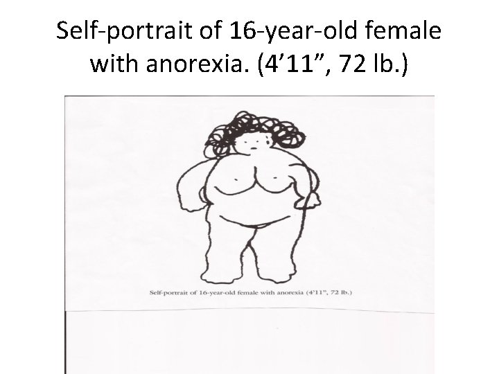 Self-portrait of 16 -year-old female with anorexia. (4’ 11”, 72 lb. ) 