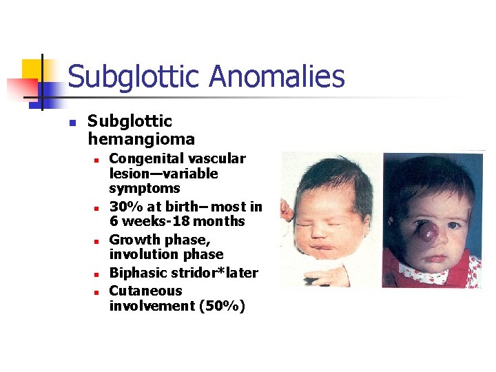 Subglottic Anomalies n Subglottic hemangioma n n n Congenital vascular lesion—variable symptoms 30% at