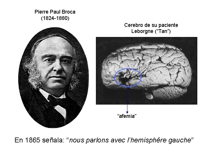 Pierre Paul Broca (1824 -1880) Cerebro de su paciente Leborgne (“Tan”) “afemia” En 1865