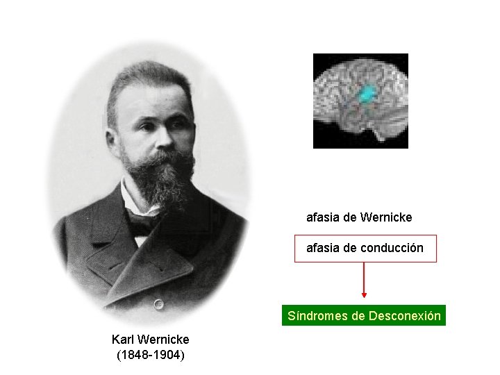 afasia de Wernicke afasia de conducción Síndromes de Desconexión Karl Wernicke (1848 -1904) 