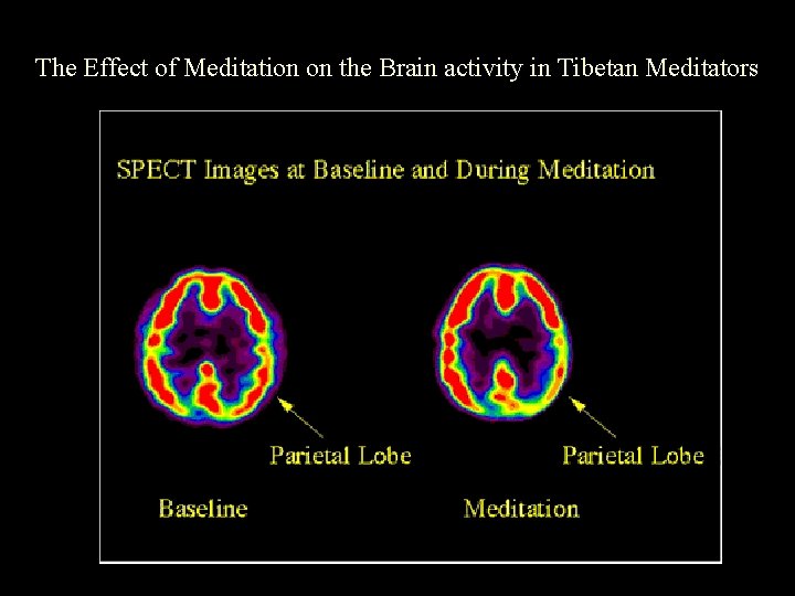 The Effect of Meditation on the Brain activity in Tibetan Meditators 