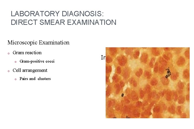 LABORATORY DIAGNOSIS: DIRECT SMEAR EXAMINATION Microscopic Examination o Gram reaction o o Gram-positive cocci