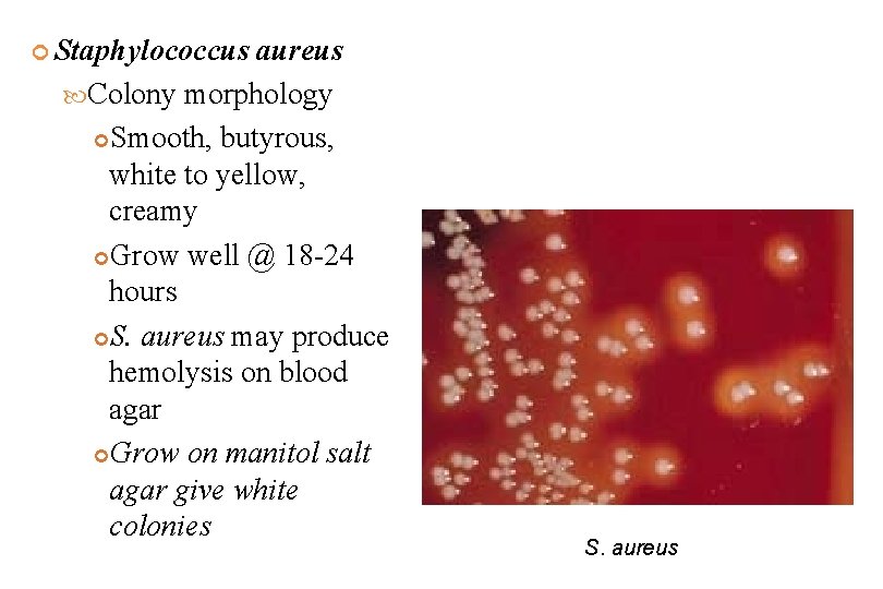  Staphylococcus aureus Colony morphology Smooth, butyrous, white to yellow, creamy Grow well @