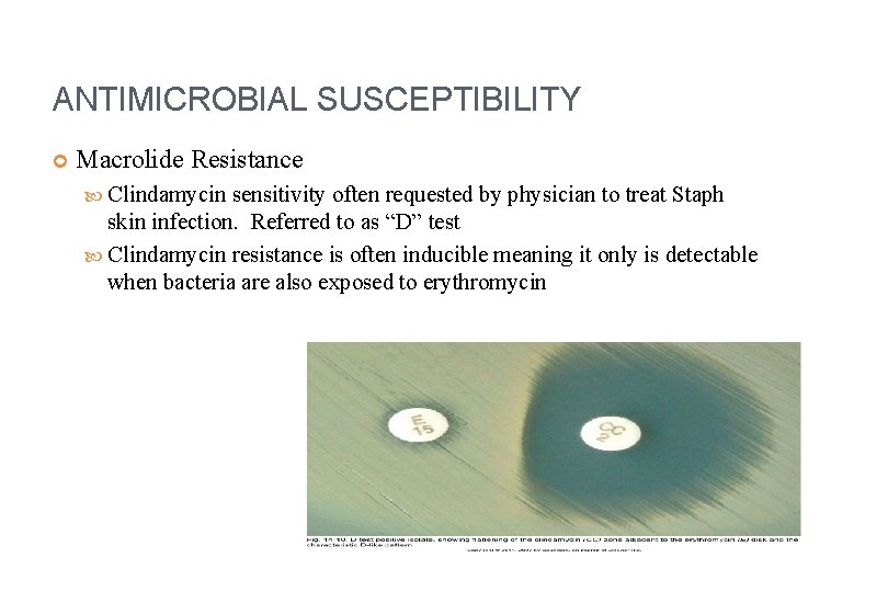 ANTIMICROBIAL SUSCEPTIBILITY Macrolide Resistance Clindamycin sensitivity often requested by physician to treat Staph skin