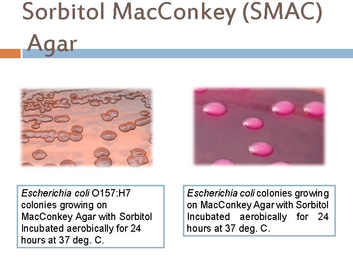 Sorbitol Mac. Conkey (SMAC) Agar Escherichia coli O 157: H 7 colonies growing on