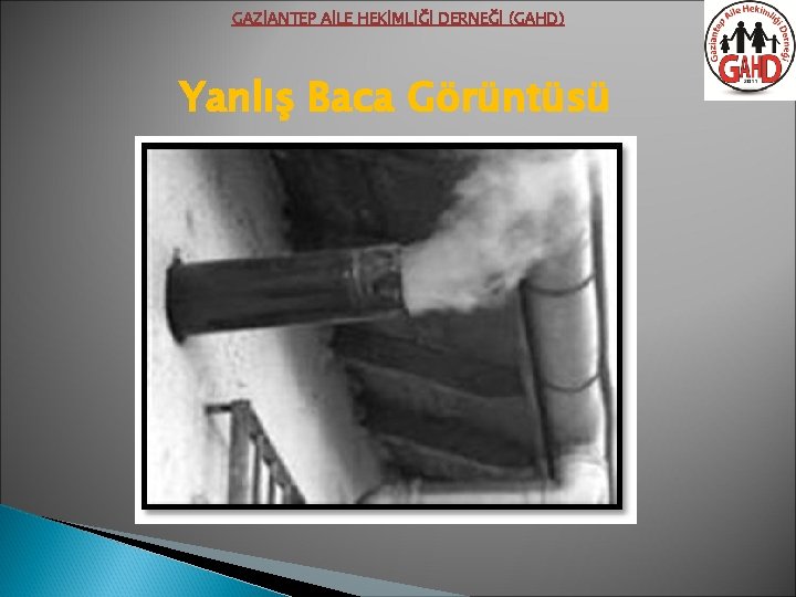 GAZİANTEP AİLE HEKİMLİĞİ DERNEĞİ (GAHD) Yanlış Baca Görüntüsü 