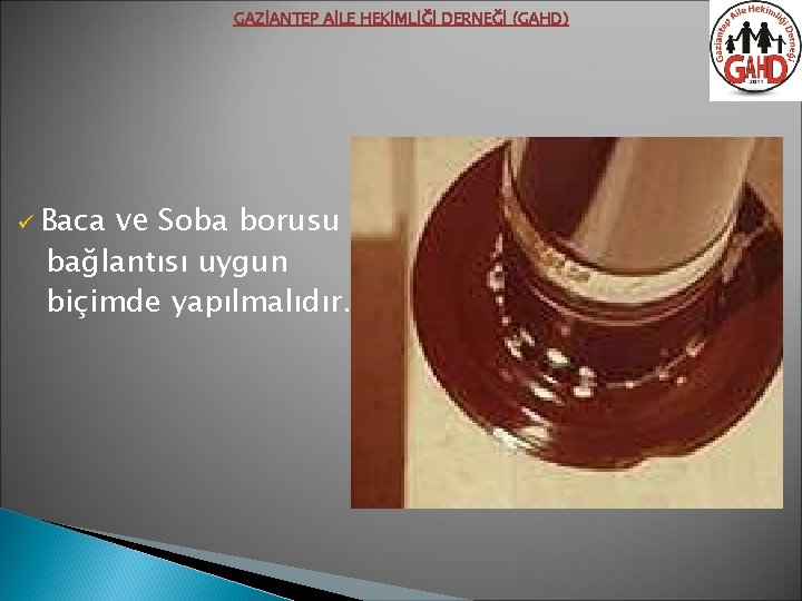 GAZİANTEP AİLE HEKİMLİĞİ DERNEĞİ (GAHD) ve Soba borusu bağlantısı uygun biçimde yapılmalıdır. ü Baca