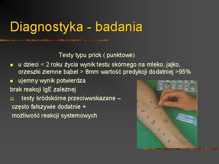 Diagnostyka - badania Testy typu prick ( punktowe) u dzieci < 2 roku życia