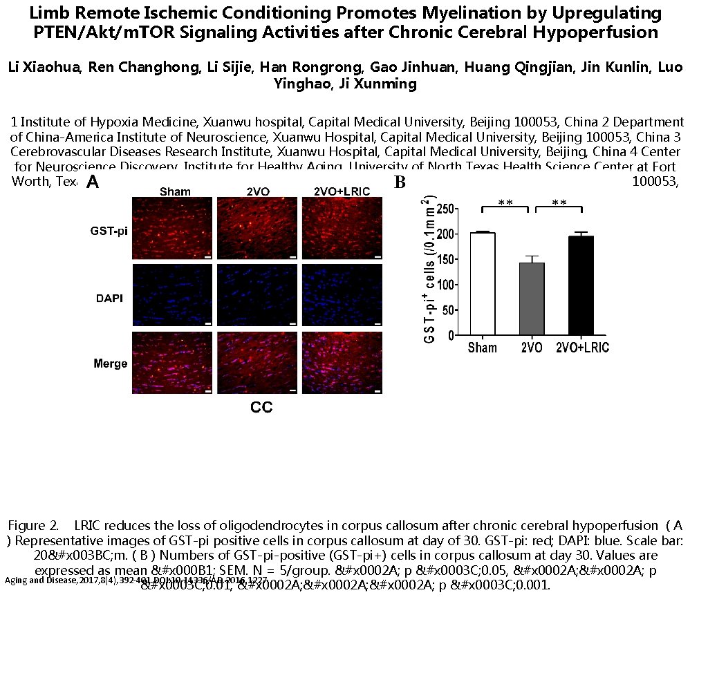 Limb Remote Ischemic Conditioning Promotes Myelination by Upregulating PTEN/Akt/m. TOR Signaling Activities after Chronic