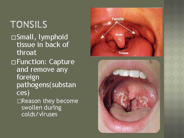 � Small, lymphoid tissue in back of throat � Function: Capture and remove any