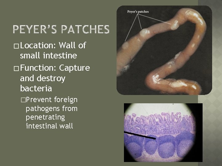 � Location: Wall of small intestine � Function: Capture and destroy bacteria �Prevent foreign