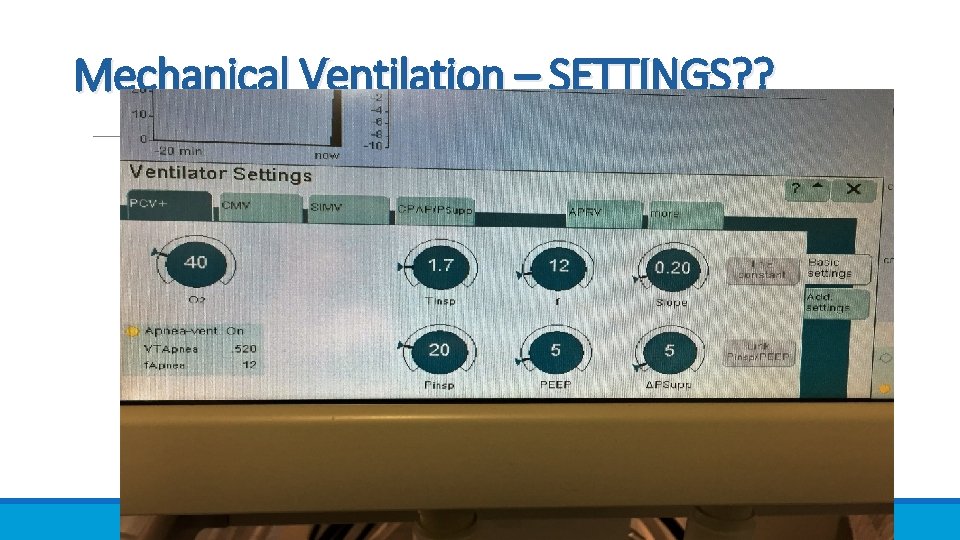 Mechanical Ventilation – SETTINGS? ? 