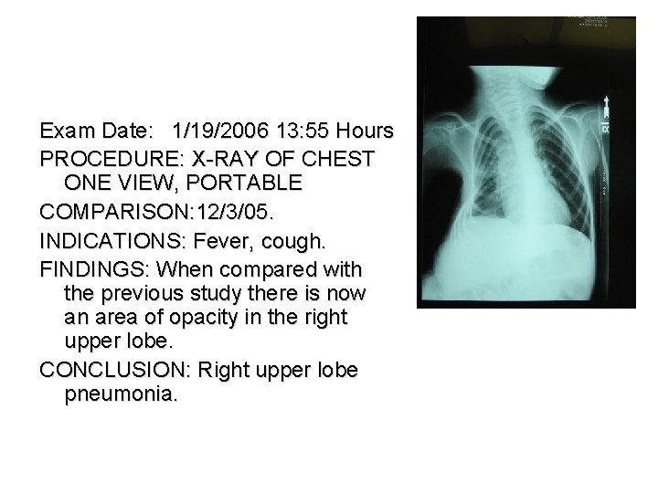 Exam Date: 1/19/2006 13: 55 Hours PROCEDURE: X-RAY OF CHEST ONE VIEW, PORTABLE COMPARISON: