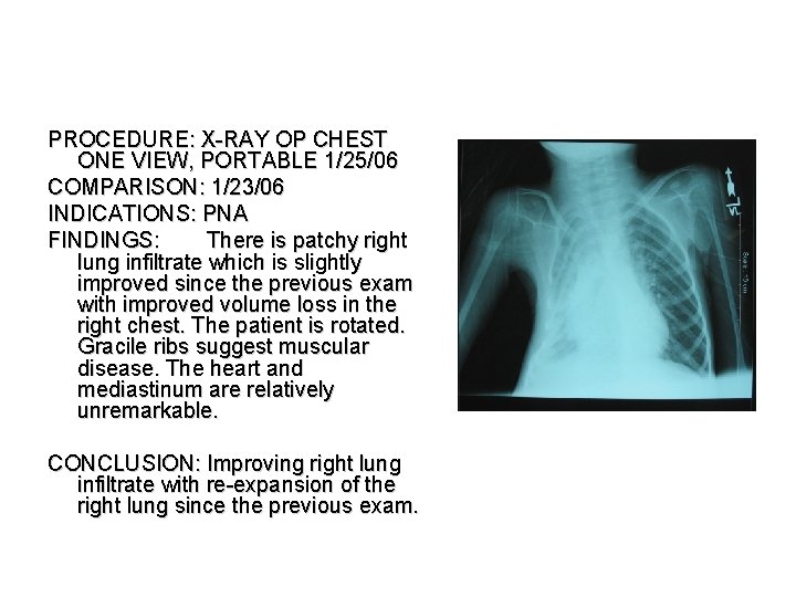 PROCEDURE: X-RAY OP CHEST ONE VIEW, PORTABLE 1/25/06 COMPARISON: 1/23/06 INDICATIONS: PNA FINDINGS: There