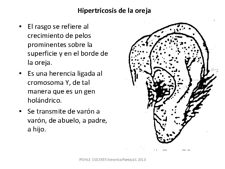 Hipertricosis de la oreja • El rasgo se refiere al crecimiento de pelos prominentes