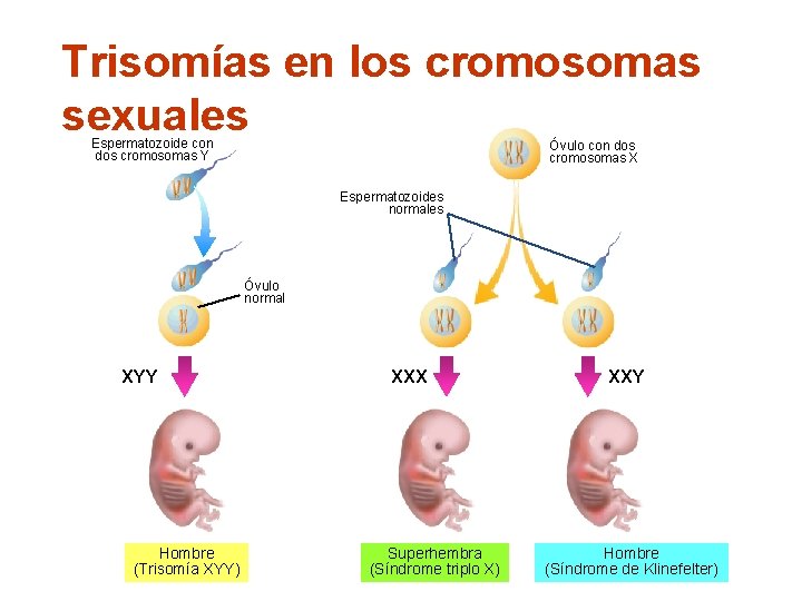Trisomías en los cromosomas sexuales Espermatozoide con dos cromosomas Y Óvulo con dos cromosomas