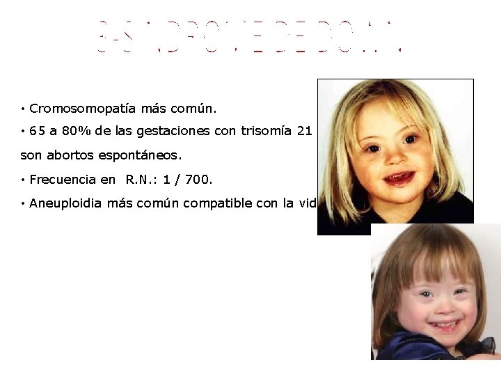  • Cromosomopatía más común. • 65 a 80% de las gestaciones con trisomía