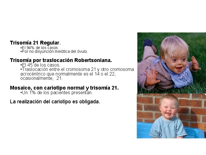 Trisomía 21 Regular. • El 94% de los casos. • Por no disyunción meiótica