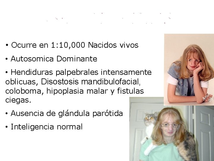  • Ocurre en 1: 10, 000 Nacidos vivos • Autosomica Dominante • Hendiduras