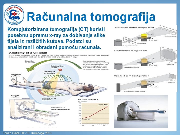 Računalna tomografija Kompjutorizirana tomografija (CT) koristi posebnu opremu x-ray za dobivanje slike tijela iz