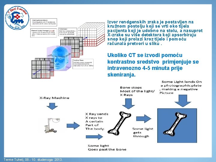 Izvor rendgenskih zraka je postavljen na kružnom postolju koji se vrti oko tijela pacijenta