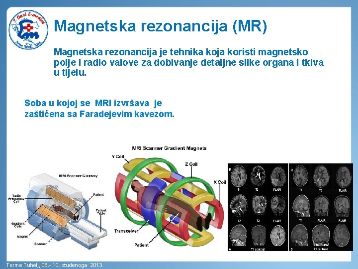 Magnetska rezonancija (MR) Magnetska rezonancija je tehnika koja koristi magnetsko polje i radio valove
