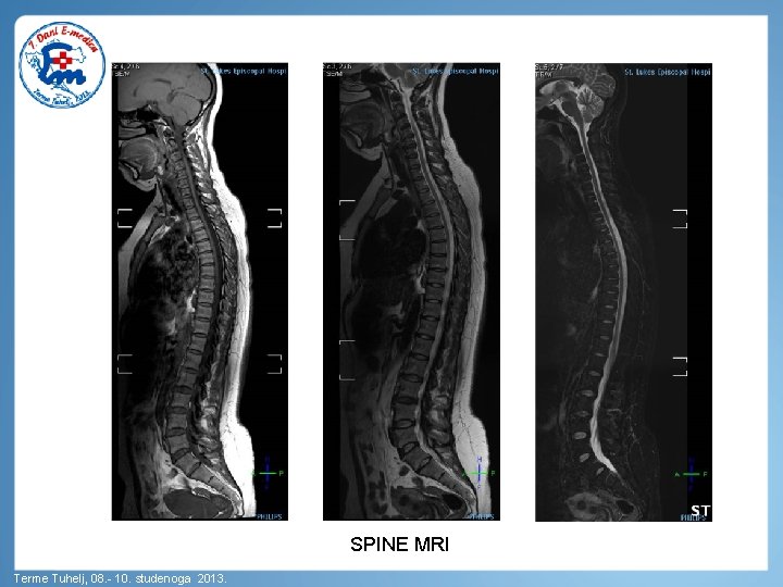 SPINE MRI Terme Tuhelj, 08. - 10. studenoga 2013. 