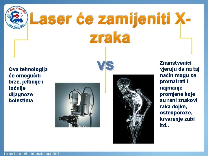 Laser će zamijeniti Xzraka Ova tehnologija će omogućiti brže, jeftinije i točnije dijagnoze bolestima