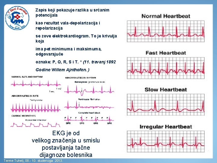 Zapis koji pokazuje razlika u srčanim potencijala kao rezultat vala-depolarizacija i repolarizacija se zove