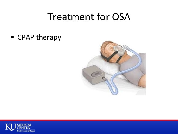 Treatment for OSA § CPAP therapy 