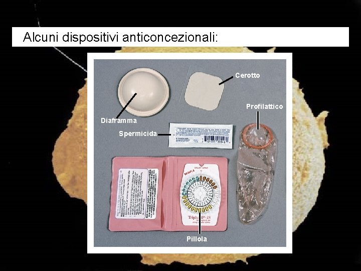 Alcuni dispositivi anticoncezionali: Cerotto Profilattico Diaframma Spermicida Figura 22. 8 Pillola 