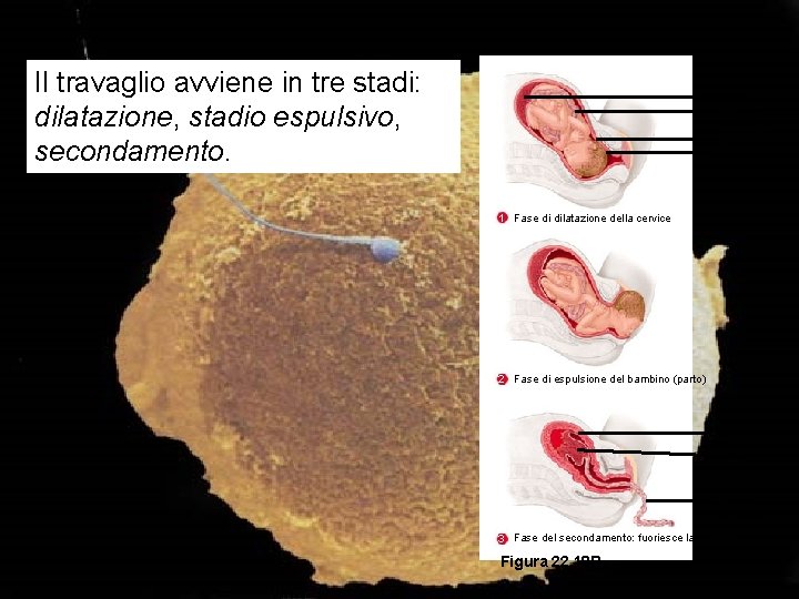 Il travaglio avviene in tre stadi: dilatazione, stadio espulsivo, secondamento. Placenta Cordone Ombelicale Utero
