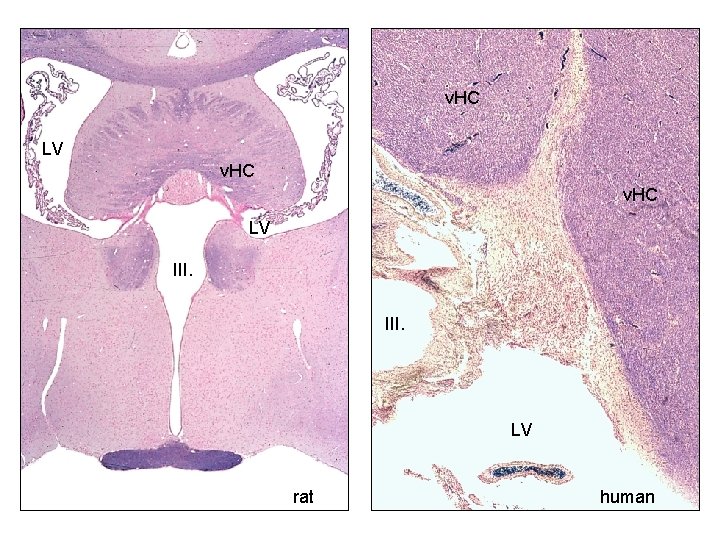 v. HC LV III. LV rat human 