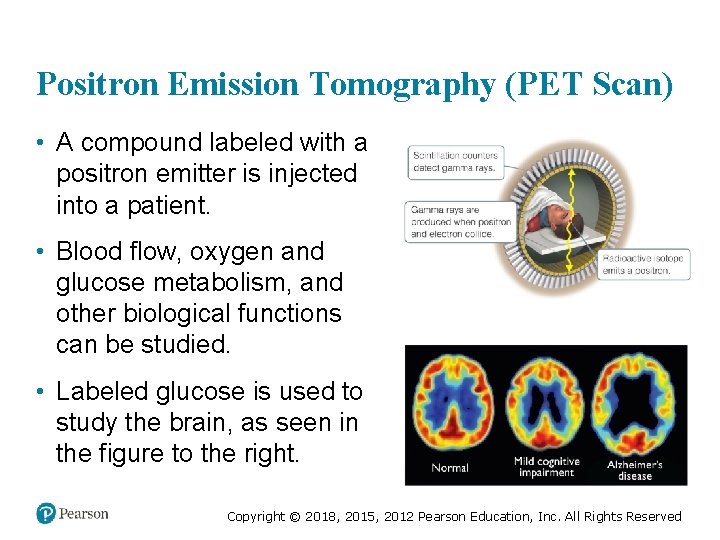 Positron Emission Tomography (PET Scan) • A compound labeled with a positron emitter is