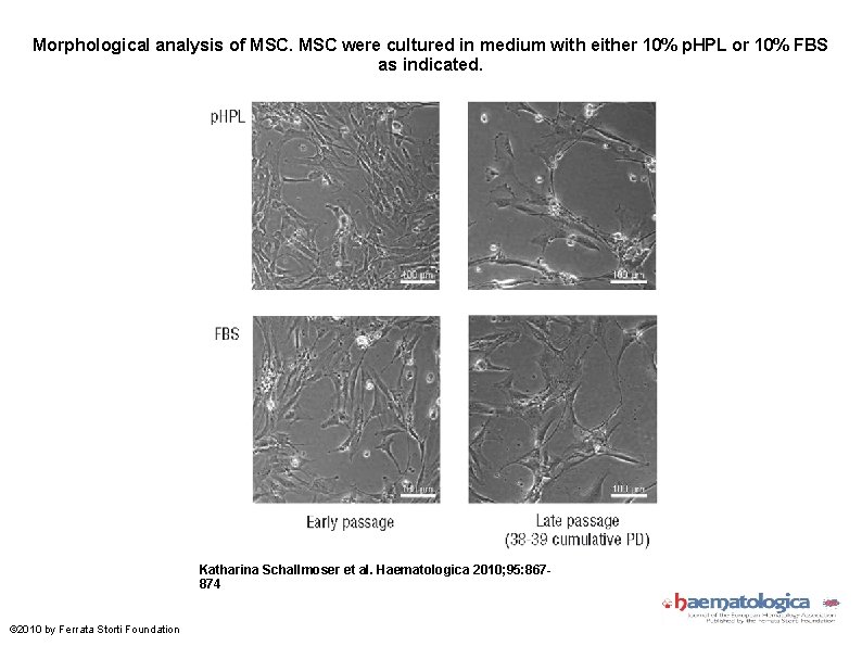 Morphological analysis of MSC were cultured in medium with either 10% p. HPL or