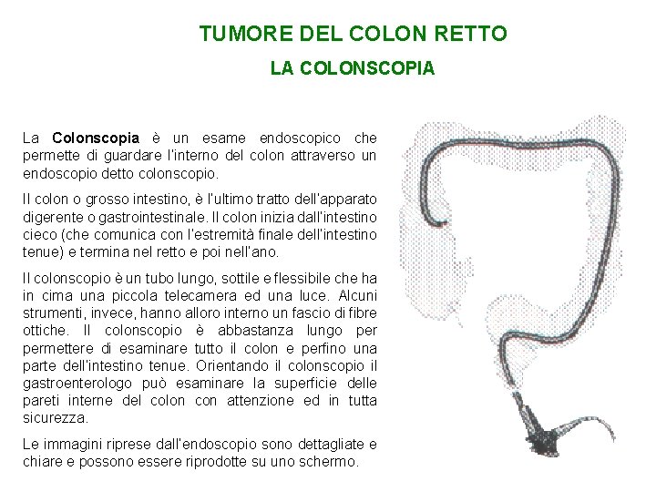 TUMORE DEL COLON RETTO LA COLONSCOPIA La Colonscopia è un esame endoscopico che permette