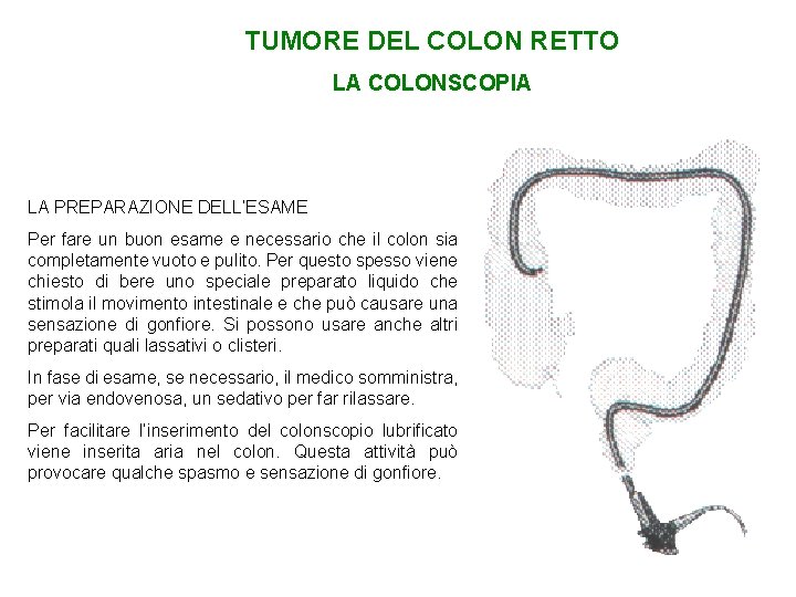 TUMORE DEL COLON RETTO LA COLONSCOPIA LA PREPARAZIONE DELL’ESAME Per fare un buon esame