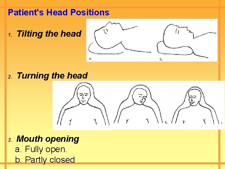 Patient's Head Positions 1. Tilting the head 2. Turning the head 3. Mouth opening
