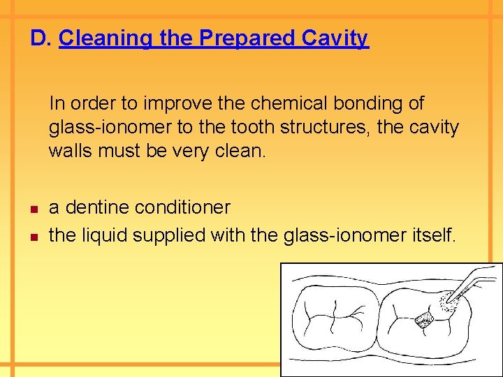 D. Cleaning the Prepared Cavity In order to improve the chemical bonding of glass-ionomer