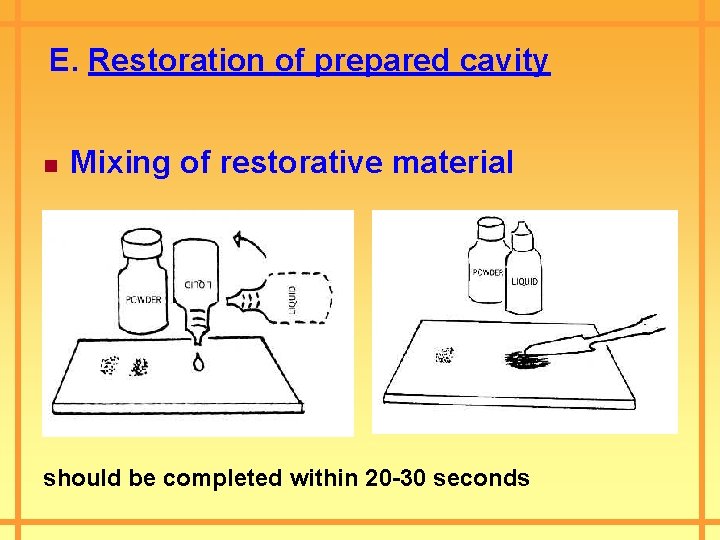 E. Restoration of prepared cavity n Mixing of restorative material should be completed within