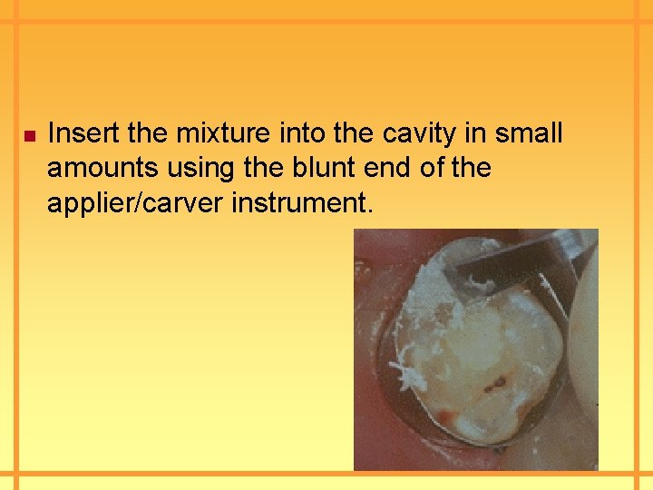n Insert the mixture into the cavity in small amounts using the blunt end