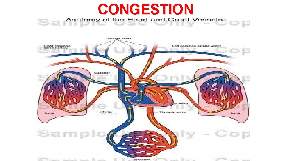 CONGESTION 